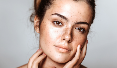Woman with Freckles