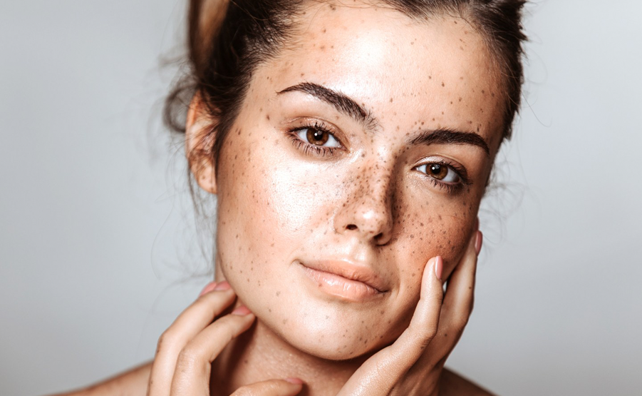 Woman with Freckles