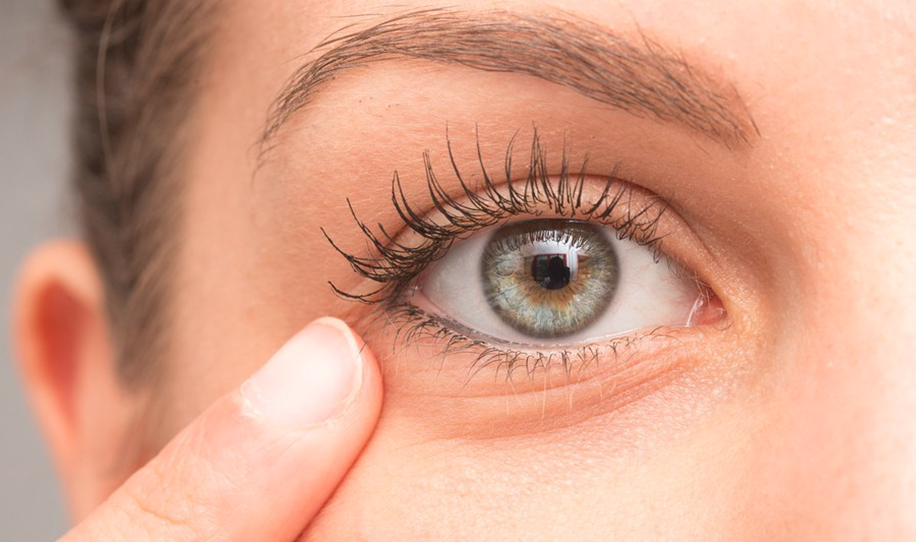 Getting Rid of Under Eye Wrinkles - Advanced Dermatology Care
