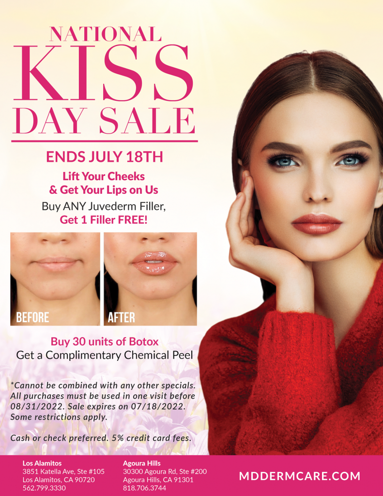 National Kiss Day Sale