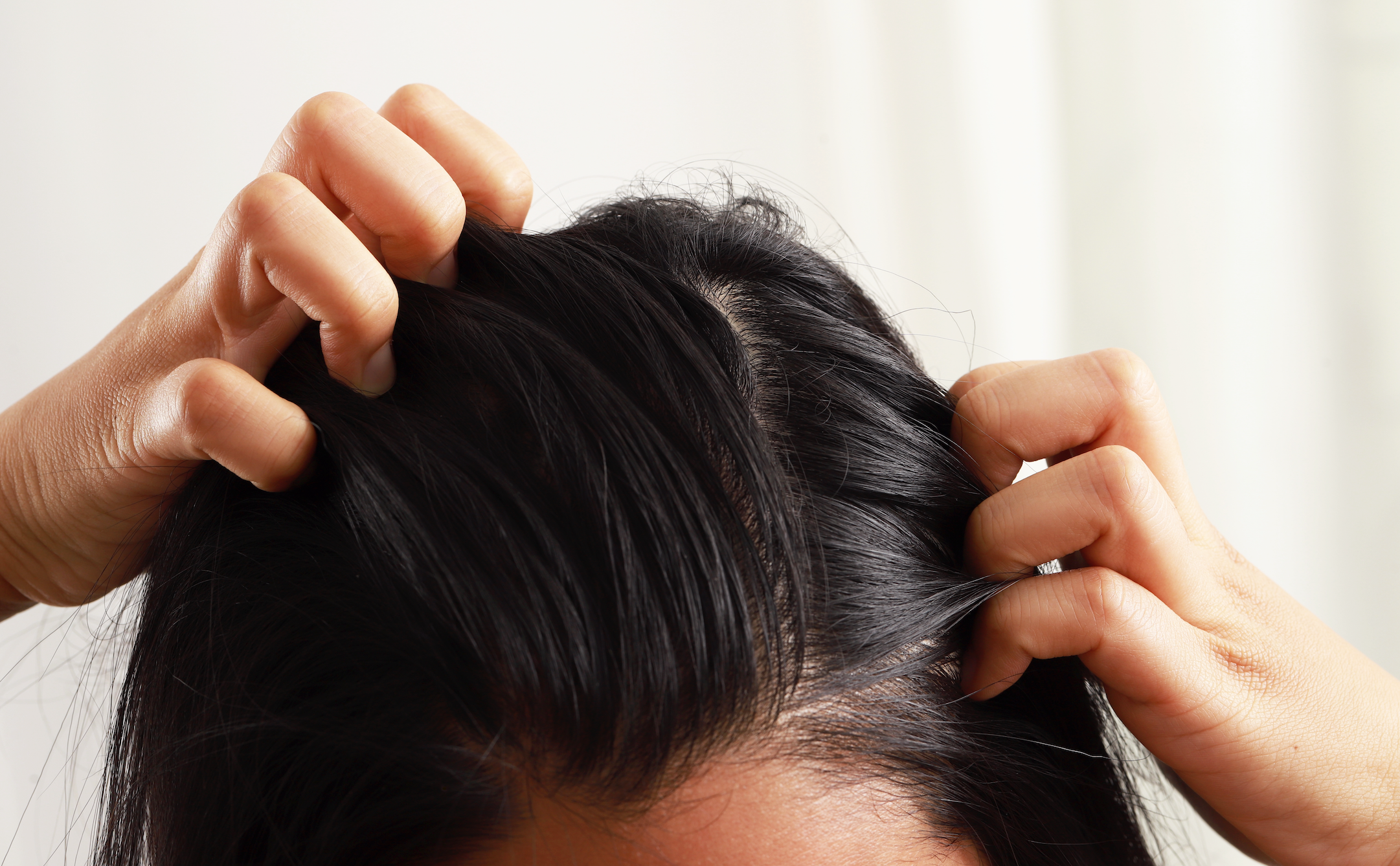How To Get Rid of Scalp Acne  Clogged Pores on Scalp  SELF
